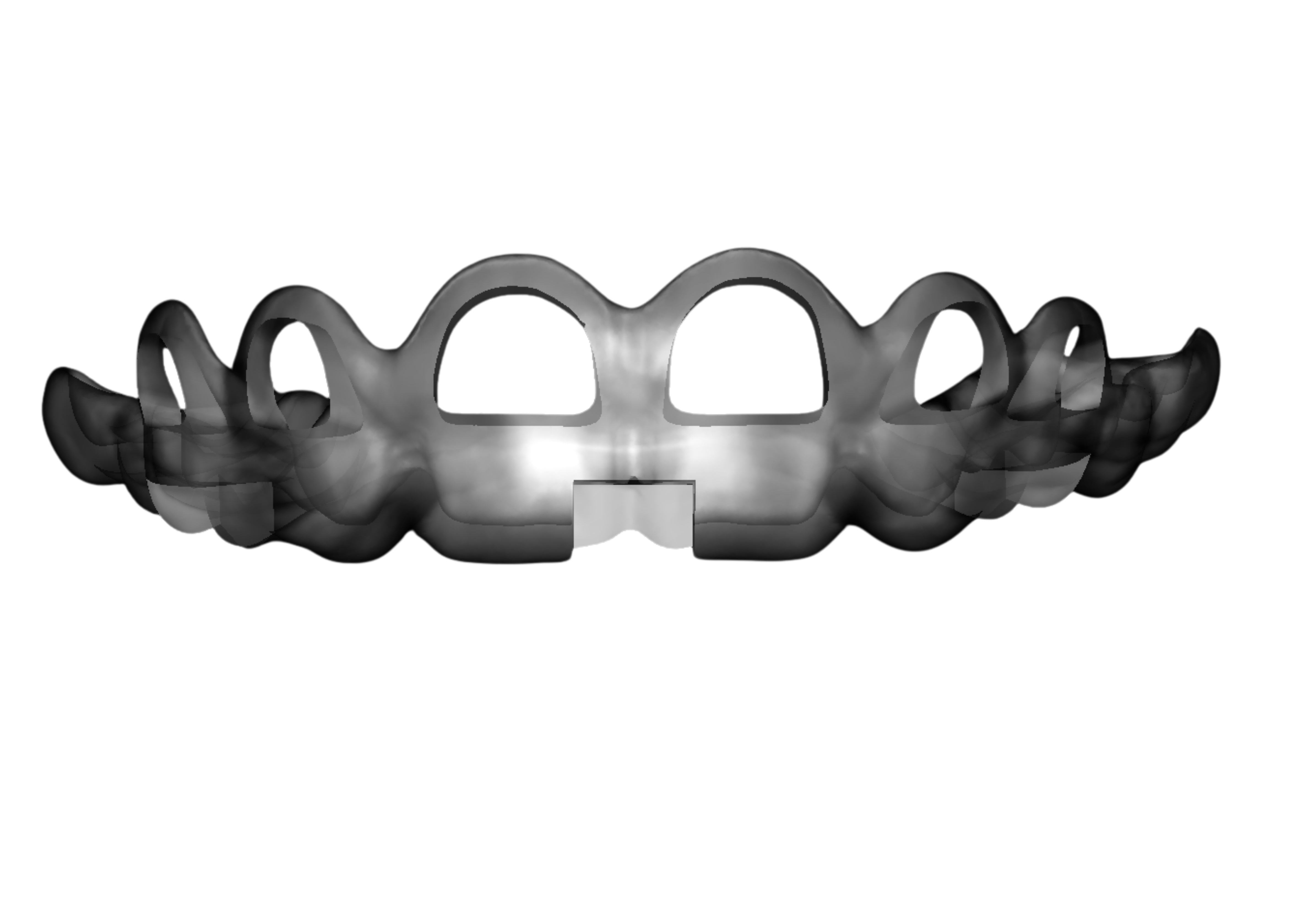 Guide de Gingivectomie